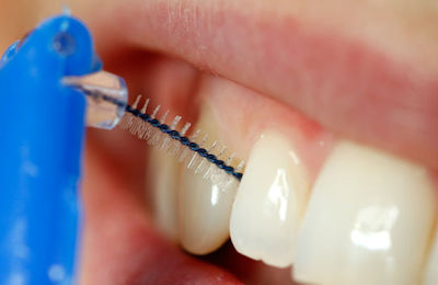 Ästhetische Zahnheilkunde Ästhetische Zahnheilkunde